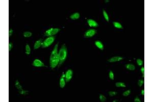 Immunofluorescent analysis of Hela cells using ABIN7148353 at dilution of 1:100 and Alexa Fluor 488-congugated AffiniPure Goat Anti-Rabbit IgG(H+L)