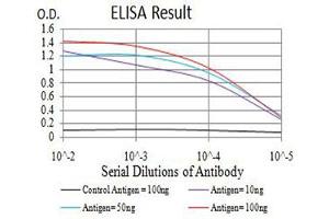 Black line: Control Antigen (100 ng),Purple line: Antigen (10 ng), Blue line: Antigen (50 ng), Red line:Antigen (100 ng)