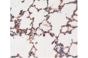 Detection of MMP12 in Rat Lung Tissue using Polyclonal Antibody to Matrix Metalloproteinase 12 (MMP12) (MMP12 anticorps  (AA 20-99))