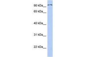 Image no. 1 for anti-Transient Receptor Potential Cation Channel, Subfamily C, Member 4 Associated Protein (TRPC4AP) (AA 359-408) antibody (ABIN6743823)