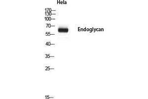Western Blot (WB) analysis of HeLa using Endoglycan antibody.