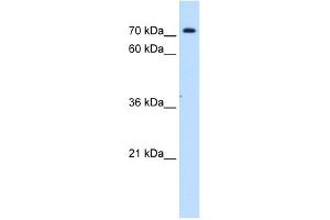 SLC5A11 antibody used at 1 ug/ml to detect target protein. (Solute Carrier Family 5 (Sodium/inositol Cotransporter), Member 11 (SLC5A11) anticorps)