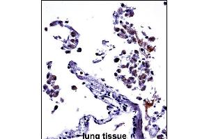 IL13 Antibody (C-term) ((ABIN657659 and ABIN2846653))immunohistochemistry analysis in formalin fixed and paraffin embedded human lung tissue followed by peroxidase conjugation of the secondary antibody and DAB staining. (IL-13 anticorps  (C-Term))