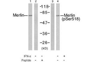 Image no. 2 for anti-Neurofibromin 2 (NF2) (pSer518) antibody (ABIN197028) (Merlin anticorps  (pSer518))