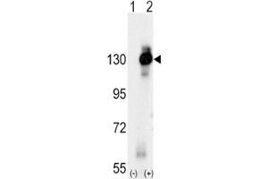 Western blot analysis of CSF1R antibody and 293 cell lysate (2 ug/lane) either nontransfected (Lane 1) or transiently transfected with the CSF1R gene (2). (CSF1R anticorps  (AA 940-971))