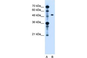 Western Blotting (WB) image for anti-Zinc Finger, FYVE Domain Containing 27 (ZFYVE27) antibody (ABIN2462817) (ZFYVE27 anticorps)