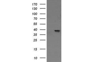 Image no. 1 for anti-Mitogen-Activated Protein Kinase Kinase 3 (MAP2K3) antibody (ABIN1499415) (MAP2K3 anticorps)