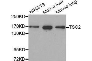 Western Blotting (WB) image for anti-Tuberous Sclerosis 2 (TSC2) antibody (ABIN5663676) (Tuberin anticorps)