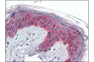 Human Skin (formalin-fixed, paraffin-embedded) stained with VAV3at 5 µg/ml followed by biotinylated anti-goat IgG secondary antibody, alkaline phosphatase-streptavidin and chromogen. (VAV3 anticorps  (Internal Region))