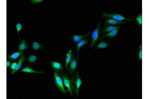 Immunofluorescent analysis of Hela cells using ABIN7143656 at dilution of 1:100 and Alexa Fluor 488-congugated AffiniPure Goat Anti-Rabbit IgG(H+L)