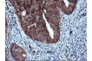 Image no. 1 for anti-Haloacid Dehalogenase-Like Hydrolase Domain Containing 1 (HDHD1) antibody (ABIN1498625) (HDHD1 anticorps)