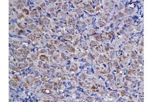 Formalin-fixed and paraffin embedded rat ovary labeled with Anti-Cyclin F Polyclonal Antibody, Unconjugated (ABIN732968) followed by conjugation to the secondary antibody and DAB staining (Cyclin F anticorps  (AA 451-550))