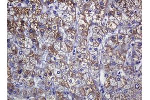 Immunohistochemistry (IHC) image for anti-Sterol O-Acyltransferase 2 (SOAT2) (AA 1-120) antibody (ABIN1490565)