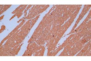 Detection of MBP in Human Cerebrum Tissue using Monoclonal Antibody to Myelin Basic Protein (MBP)