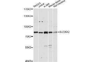 Western blot analysis of extracts of various cell lines, using SLC26A2 antibody. (SLC26A2 anticorps)