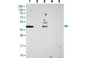 Western blot analysis of Lane 1: RT-4, Lane 2: U-251 MG, Lane 3: Human Plasma, Lane 4: Liver, Lane 5: Tonsil with FAM113B polyclonal antibody . (PCED1B anticorps)