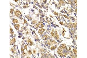 Immunohistochemistry of paraffin-embedded Human stomach using METTL7B Polyclonal Antibody at dilution of 1:100 (40x lens).