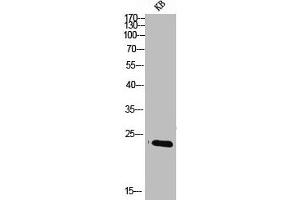 Western blot analysis of KB lysis using SRp20 antibody.