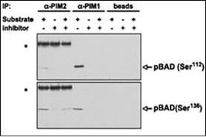 PIM proteins were immunoprecipitated from MV4,11 cells and the agarose-protein A-immunoprecipitate complex was tested for its ability to phosphorylate BAD in vitro in the presence or absence of .