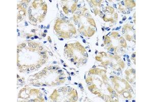 Immunohistochemistry of paraffin-embedded Human stomach using NDUFB10 Polyclonal Antibody at dilution of 1:100 (40x lens). (NDUFB10 anticorps)