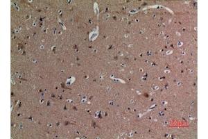 Immunohistochemical analysis of paraffin-embedded human-brain, antibody was diluted at 1:100. (alpha Tubulin anticorps  (acLys40))
