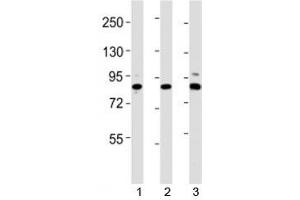 Western blot testing of Suz12 antibody at 1:2000 dilution. (SUZ12 anticorps  (AA 381-395))