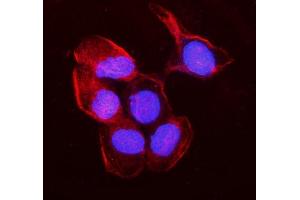 IF analysis of non-muscle Myosin IIB/MYH10 using anti-non-muscle Myosin IIB/MYH10 antibody (ABIN7603186). (MYH10 anticorps  (N-Term))