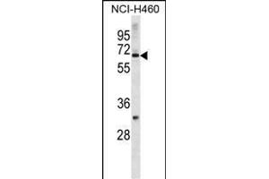 ZN Antibody (N-term) (ABIN1882016 and ABIN2838710) western blot analysis in NCI- cell line lysates (35 μg/lane). (Zinc Finger Protein 185 anticorps  (N-Term))