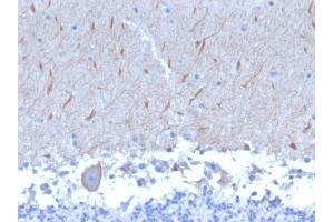 Formalin-fixed, paraffin-embedded human Brain stained with ATG5 Mouse Monoclonal Antibody (ATG5/2553). (ATG5 anticorps  (AA 1-119))