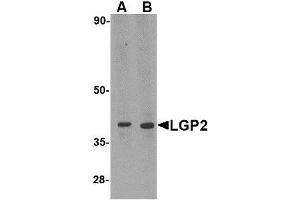 Image no. 1 for anti-DEXH (Asp-Glu-X-His) Box Polypeptide 58 (DHX58) (N-Term) antibody (ABIN1494350) (DHX58 anticorps  (N-Term))