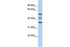 WB Suggested Anti-TRIM68 Antibody Titration:  0. (TRIM68 anticorps  (Middle Region))