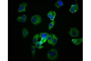 Immunofluorescence staining of MCF-7 cells with ABIN7127824 at 1:39, counter-stained with DAPI. (Recombinant Src anticorps)