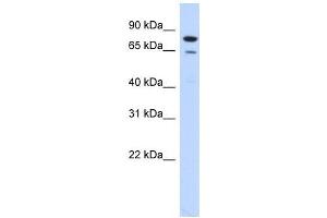RMI1 antibody used at 1 ug/ml to detect target protein. (RMI1 anticorps)