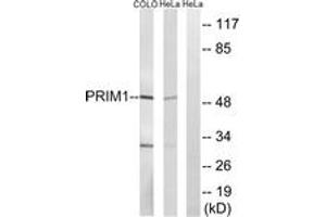 Western blot analysis of extracts from COLO/HeLa cells, using PRIM1 Antibody. (PRIM1 anticorps  (AA 371-420))