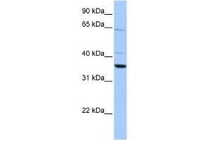 Calponin 2 antibody used at 1 ug/ml to detect target protein. (CNN2 anticorps  (N-Term))