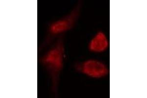 ABIN6274990 staining  COLO205 cells by IF/ICC. (CEP57 anticorps  (Internal Region))