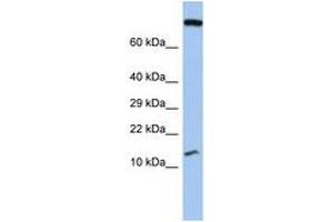 Image no. 1 for anti-Chromosome 5 Open Reading Frame 64 (C5ORF64) (AA 71-120) antibody (ABIN6743861) (C5ORF64 anticorps  (AA 71-120))