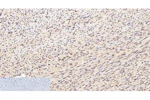 Immunohistochemistry of paraffin-embedded Human uterus tissue using Lamin B1 Monoclonal Antibody at dilution of 1:200.