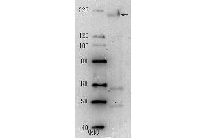 Western Blotting (WB) image for anti-SARS-Coronavirus Spike Protein (SARS-CoV S) antibody (ABIN2452119) (SARS-CoV Spike anticorps)