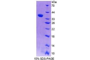 SDS-PAGE analysis of Mouse EPB41 Protein. (EPB41 Protéine)