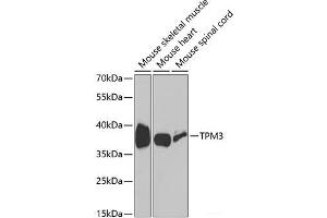 Western blot analysis of extracts of various cell lines using TPM3 Polyclonal Antibody at dilution of 1:1000. (TPM3 anticorps)