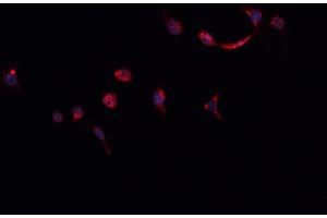 ABIN6268824 staining HeLa cells by IF/ICC. (HNRNPM anticorps  (N-Term))
