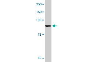 PYGM monoclonal antibody (M10), clone 2C4.