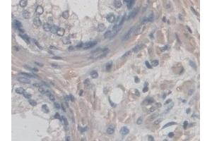 Detection of CD209 in Human Prostate Tissue using Polyclonal Antibody to Cluster Of Differentiation 209 (CD209)