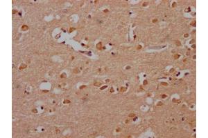 IHC image of ABIN7166499 diluted at 1:200 and staining in paraffin-embedded human brain tissue performed on a Leica BondTM system. (Src anticorps  (AA 2-100))
