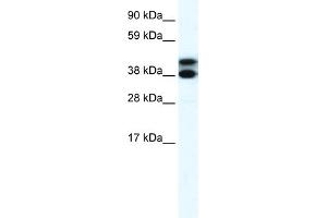 WB Suggested Anti-RFP2 Antibody Titration:  0. (TRIM13 anticorps  (Middle Region))
