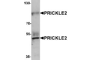 Western blot analysis of PRICKLE2 in A-20 lysate with PRICKLE2 antibody at 1 µg/mL. (PRICKLE2 anticorps  (Middle Region))