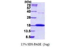 SDS-PAGE (SDS) image for Ribonuclease, RNase A Family, 7 (RNASE7) (AA 29-156) protein (His tag) (ABIN5778796) (RNASE7 Protein (AA 29-156) (His tag))