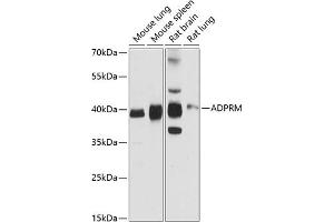 Western blot analysis of extracts of various cell lines, using ADPRM antibody (ABIN6131440, ABIN6136589, ABIN6136590 and ABIN6216678) at 1:3000 dilution. (ADPRM anticorps  (AA 203-342))