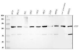 Western blot analysis of ACLY using anti-ACLY antibody (ABIN4886416).